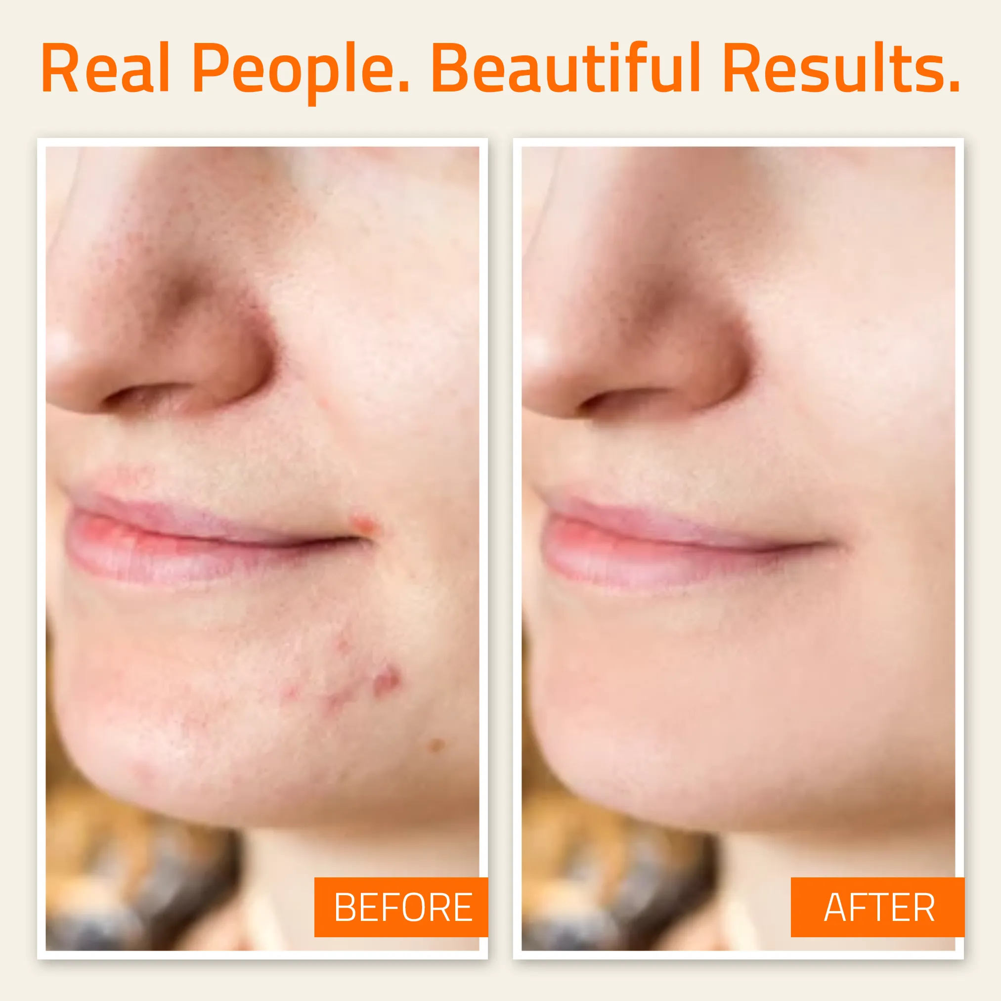 Blemish Defense Set